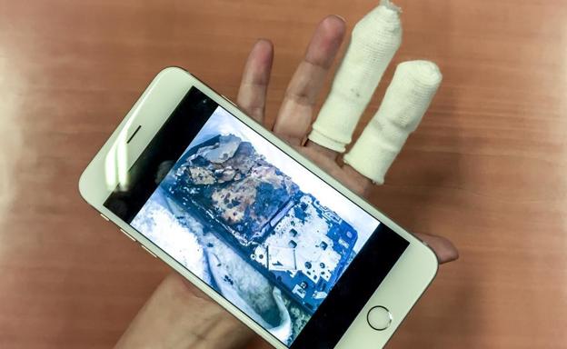 N.R. muestra su mano herida mientras sostiene una foto del móvil calcinado.