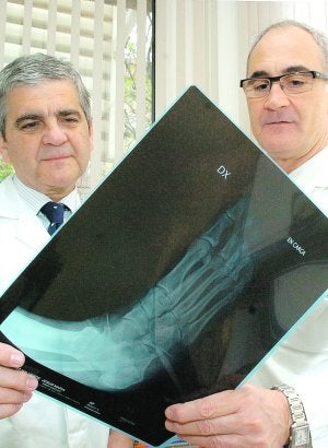 De Prado y Ripoll observan una radiografía. :: GUILLERMO CARRIÓN / AGM/