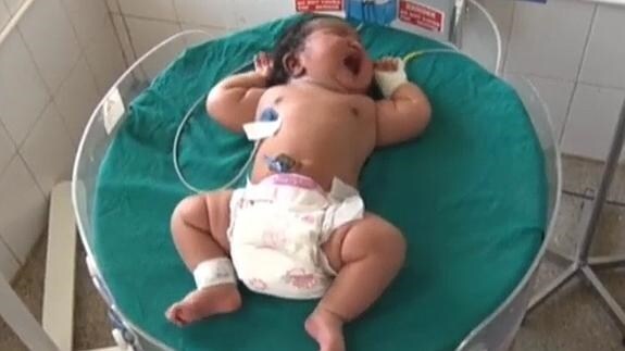 Una Mujer Da A Luz En La India A Un Bebe De 7 Kilos La Verdad